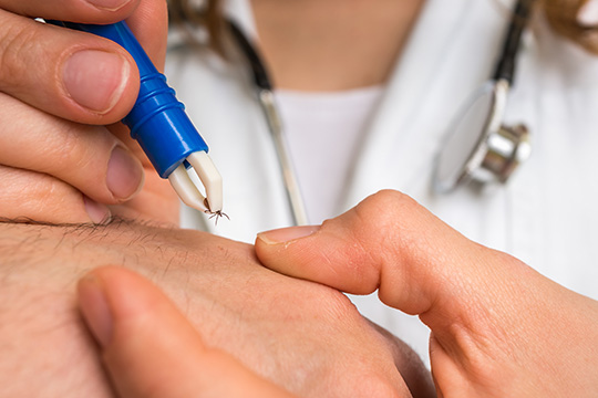 Lyme Doctor Bloomington MN